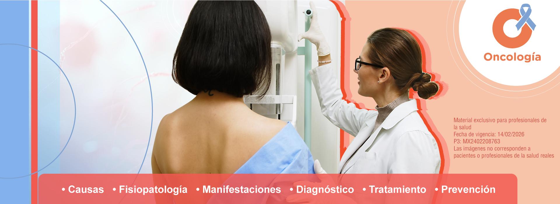 Cáncer de mama: Información médica con MedForum